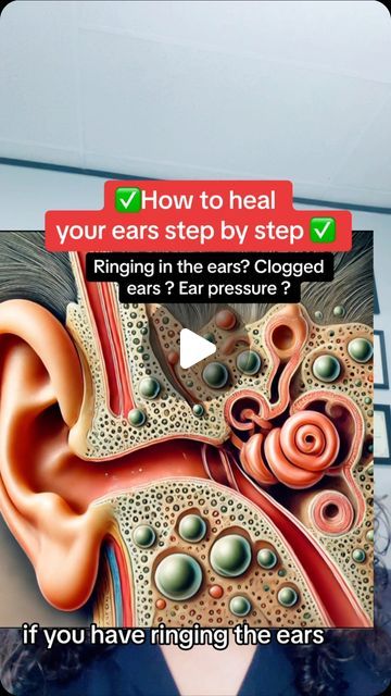 Raw (Mourab) Maraby on Instagram: "✅Ringing in the ears ears? Clogged ears pressure #hearingloss earpressure ear #ringingintheears #earwaxremoval" How To Drain Ears Fluid, How To Get Rid Of Ringing In The Ears, Pressure In Ears How To Relieve, Ear Ringing Remedy, Ear Health Tips, Clogged Ears From A Cold, Drain Ear Fluid, Ear Exercise, Clogged Ear Remedy