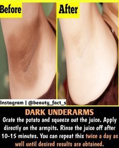 Clear Underarms, Beginner Skin Care Routine, Vaseline Beauty Tips, Natural Face Cleanser, Natural Skin Care Ingredients, Natural Skin Care Remedies, Diy Skin Care Routine, Dark Underarms, Good Skin Tips