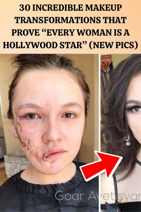 Bad Celebrity Plastic Surgery, Healthy Baby Boy, Boredpanda Pins, Celebrity Plastic Surgery, Beauty Mask, Simple Nail Art Designs, Makeup Transformation, Beauty Cream, Funny Story