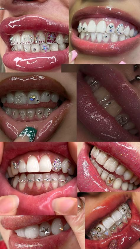 Pretty Teeth, Dental Jewelry, Grillz Teeth, Charm Bracelets For Girls, Gem Tattoo, Cute Braces, Diamond Teeth, Dope Jewelry Accessories, Tooth Gems