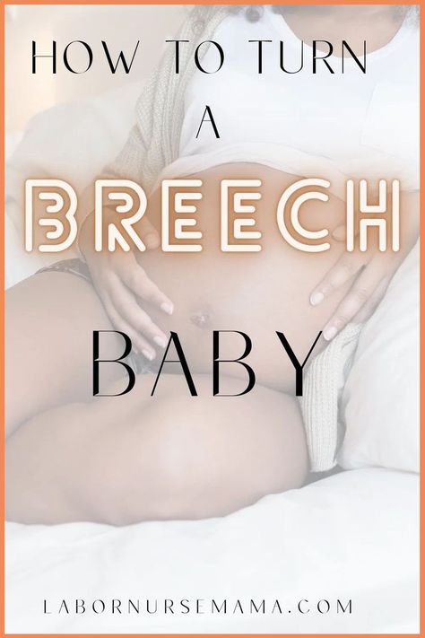 Learn exactly how to turn your breech baby. Several practical tips from a labor nurse. You have to see. Turn A Breech Baby, Webster Technique, Birth Advice, Breech Baby, Breech Babies, Abdominal Binder, Labor Nurse, Birthing Classes, Prepare For Labor