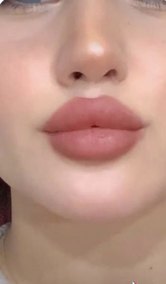 Rounded Cupids Bow Lips, Bow Lips, Cupids Bow Lips, Lips Inspiration, Wax Roller, Botox Lips, Lips Photo, Facial Aesthetics, Makeup Accesories