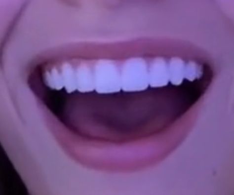 Smile Tips, Teeth Aesthetic, Pretty Teeth, Windows To The Soul, Beautiful Teeth, Straight Teeth, Perfect Teeth, Lashes Mascara, Smile Teeth