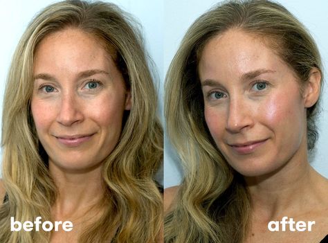 I Tried At-Home Fillers, And The Results May Surprise You Aging Face, Natural Facial, Facial Skin Care Routine, Beauty Remedies, Skin Care Steps, Skincare Video, Anti Aging Treatments, Beauty Style, Skin Care Acne