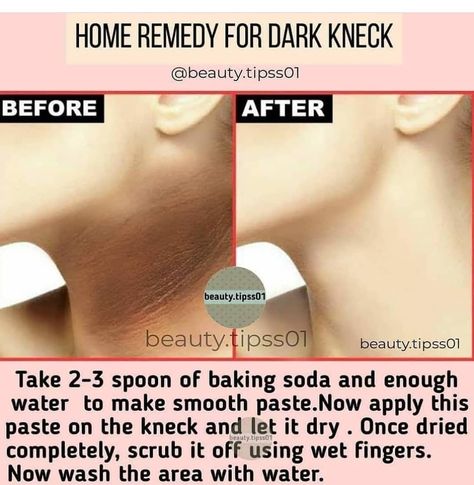 Remedy For Dark Neck, Dark Neck Remedies, Dark Neck, Beginner Skin Care Routine, Diy Skin Care Routine, Serious Skin Care, Good Skin Tips, Wave Goodbye, Healthy Skin Tips