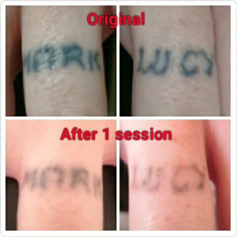 Nice fades after one laser session on these finger tattoos. www.the-missing-ink.co.uk  #GetRidOfYourInk #DoingItProperly #LovingTheFade #TattooRegret #TattooRemoval #LaserTattooRemoval #Woodley #Stockport #Manchester #Cheshire #NorthWest No Regrets Tattoo, Finger Hands, Laser Tattoo Removal, Tattoo Removal, Hand Tattoo, Progress Pictures, Finger Tattoos, Paw Print Tattoo, Hand Tattoos