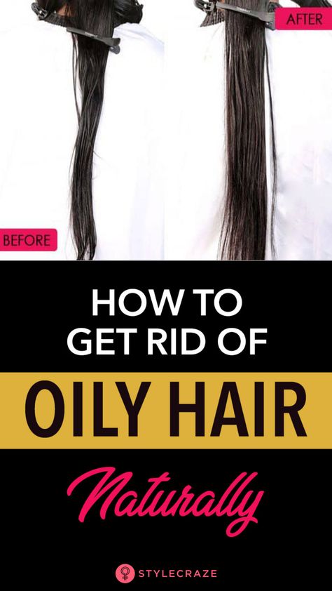 Greasy Hair Remedies, Get Rid Of Oily Hair, Prevent Oily Hair, Melting Makeup, Oily Hair Remedies, Greasy Hair, Hair Issues, Oily Scalp, Greasy Hair Hairstyles