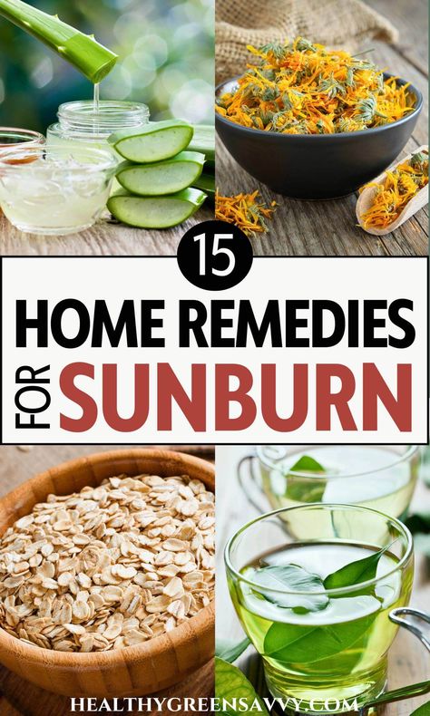 Home Remedy For Sunburn, Remedies For Sunburn, Herbal First Aid, Home Remedies For Sunburn, Remedies For Mosquito Bites, Heal Sunburn, Herbs For Sleep, Natural Remedies For Sunburn, Sore Throat Remedies