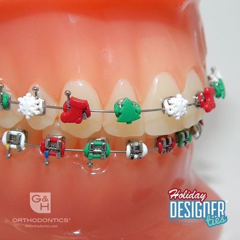 DesignerTies Orthodontics braces ligature ties with designs Christmas Braces Colors, Christmas Braces, Pink Braces, Dental Braces Colors, Orthodontist Office, Black Braces, Cute Braces Colors, Getting Braces, Braces Tips