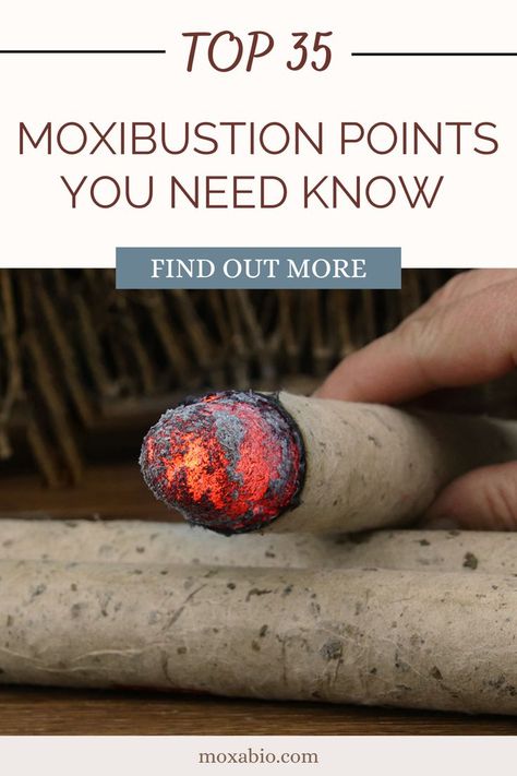 Top 35 Moxibustion Points You Need Know Trigger Points, Holistic Approach, Acupuncture, The Body, The Top, Health