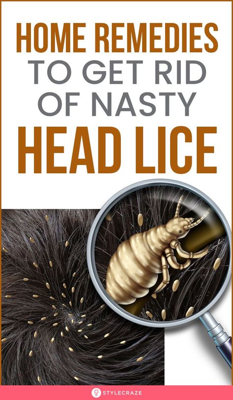 Home Remedies To Get Rid Of Nasty Head Lice: Click to find out the top effective and safe home remedies to get rid of lice and nits in hair. #remedies #HomeRemedies #NaturalRemedies #HeadLice Lice Remedies, Hair Problem, Lice Removal, Head Louse, Health Articles Wellness, Health Fitness Inspiration, Heath And Fitness, Diet Healthy, Natural Care