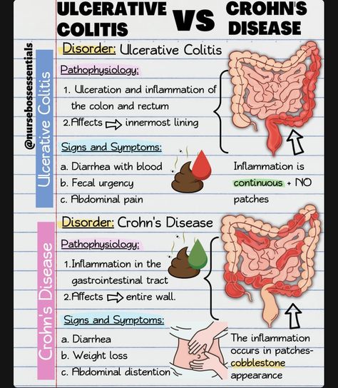 Pathophysiology Nursing, Nursing School Studying Cheat Sheets, Nursing School Life, Nursing Information, Nursing Cheat, Nursing School Essential, Medical School Life, Nursing School Motivation, Nurse Study Notes