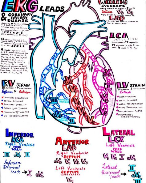 364 Likes, 10 Comments - Katy Hanson (@insta_anatomy) on Instagram: “EKG leads and the coronary arteries...this plus my 2 other recent #EKG posts make the perfect…” Cardiology Study, Ekg Leads, Student Doctor, Paramedic School, Medical Student Study, Cardiac Nursing, Nursing School Survival, Nursing School Studying, Nursing School Tips