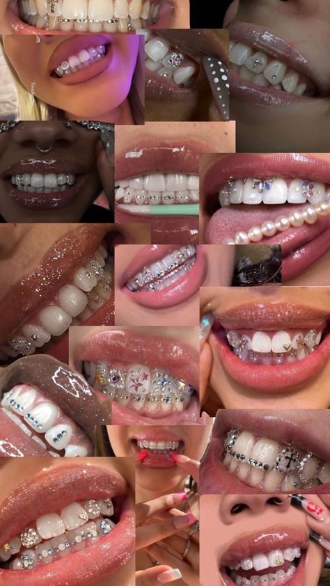 Teeth Gems Diy, Bijoux Piercing Septum, Money Tricks, Trippy Tattoo, Pretty Teeth, Dental Jewelry, Grillz Teeth, Xoxo Jewelry, Cute Braces