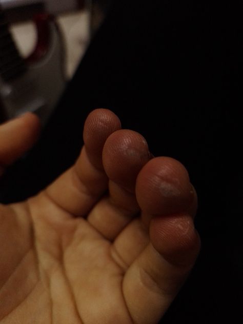 . Guitarist Fingers, Finger Bandages, Weird Girl, Guitar Fingers, Core Core, Finger Guard, Play Guitar, Ap Art, Playing Guitar