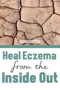 Contact Dermitis Hands, Ezcema Diet, Holistic Remedies, 2023 Vision, Healing Food, Holistic Nutrition, Cartoon Girl, Healthy Eating Habits, Top Pins