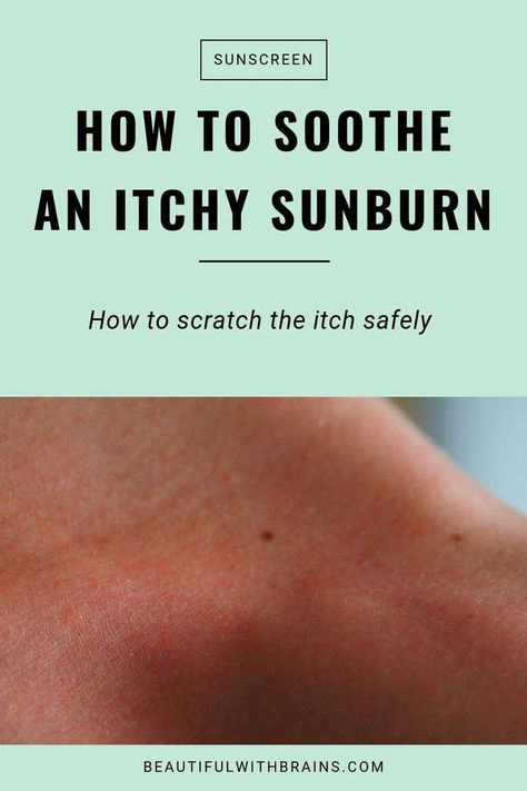 How to soothe an itchy sunburn and how to scratch the itch safely. #skincare #sunburn #sunprotection Sunburn Itch Relief, Itchy Sunburn, Anti Itch Remedy, Best For Sunburn, How To Help Sunburn, Itching Remedies, Get Rid Of Sunburn, Suntanned Skin, Burn Relief