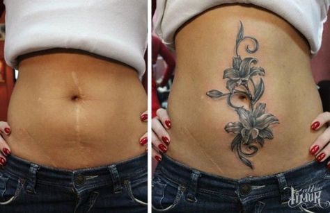 This Tummy Scar Blooms Into a  is listed (or ranked) 21 on the list The Coolest Scar Tattoos Belly Button Tattoos, Abdomen Tattoo, Belly Button Tattoo, Tummy Tattoo, Button Tattoo, Tattoo Over Scar, Stomach Tattoos Women, Scar Cover Up, Tattoos To Cover Scars