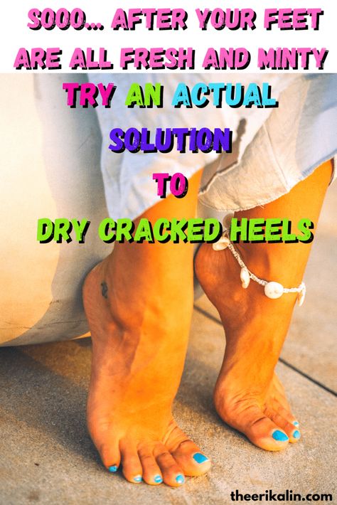 hydrogen peroxide soak for dry cracked heels. Remove dead skin from feet. Cracked Feet Remedies, Heal Cracked Heels, Foot Care Routine, Cracked Heel Remedies, Diy Foot Soak, Foot Soak Recipe, Feet Remedies, Foot Care Products, Foot Soaks