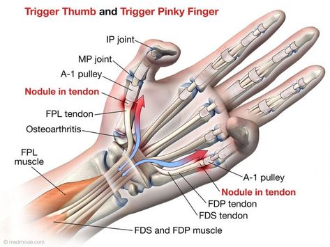 Hand Massages, Arms Muscles, Vintage Nursing, Ulnar Nerve, Forearm Muscles, Elbow Pain, Medical Student Study, Trigger Finger, Study Flashcards