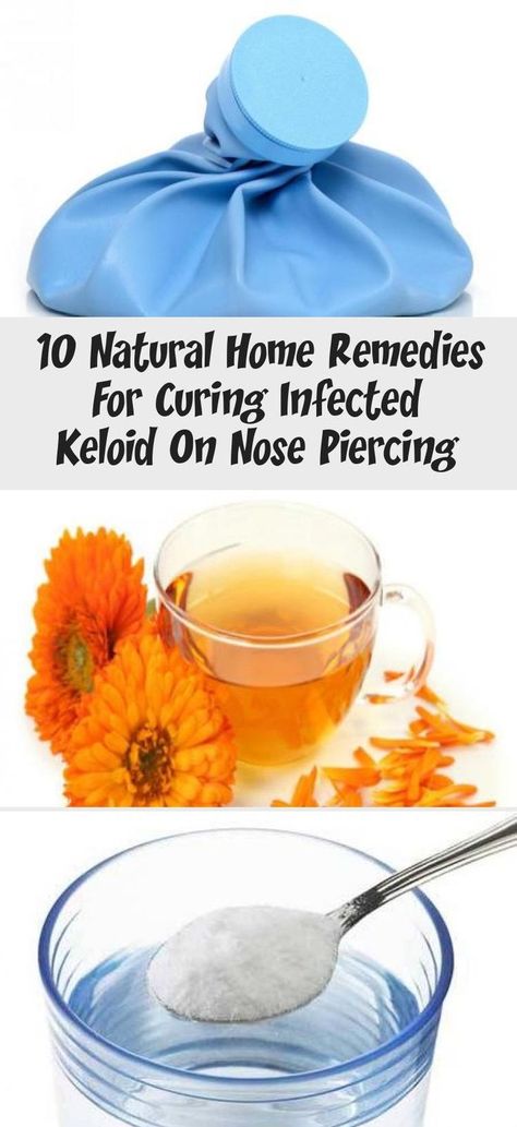 Details of 10 Natural Home Remedies For Curing Infected Keloid On Nose Keloids Home Remedies, Infected Nose Piercing, Blood Vessels On Face, Nose Piercing Scar, Natural Facial Hair Removal, Nose Piercing Bump, Piercing Bump, Natural Facial, Skin Tissue