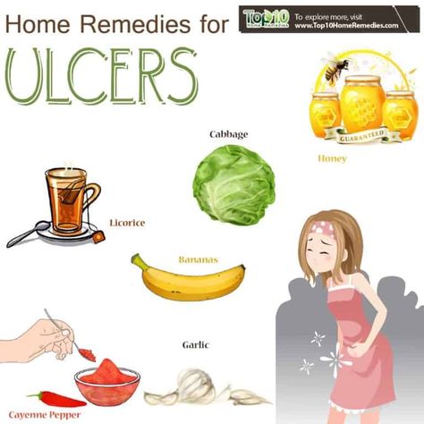 home remedies for ulcers Food For Stomach Ulcers, Foods For Ulcers, Heal Stomach, Stomach Ulcers Symptoms, Ulcer Remedies, Ulcer Symptoms, Ulcer Diet, Stomach Remedies, Reflux Remedies