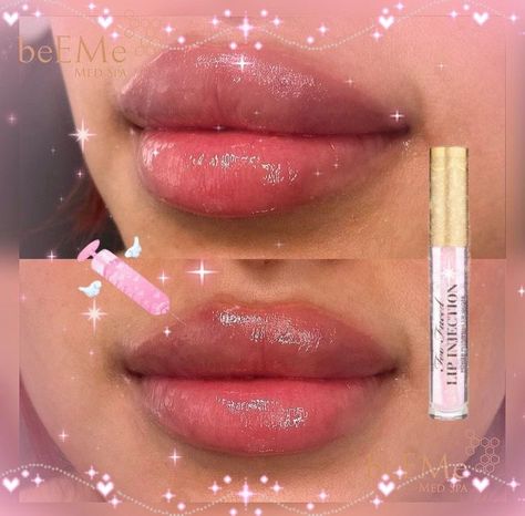 STRAWBERRIEKISSES♡ on Twitter: "https://t.co/wCsarZqLjd" / Twitter Brats Doll Lip Filler, Bratz Lip Filler, Bratz Doll Lip Filler, Doll Lips Filler, Round Lips Filler, Bratz Doll Lips, Bratz Lips, Bratz Doll Makeup, Fairy Eyes