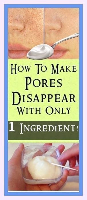 I’m happy to be a part of… Splendiferous information! Big Pores On Face, Get Rid Of Pores, Pores On Face, Beauty Tips With Honey, Big Pores, Face Pores, Smaller Pores, Beauty Routine Tips, Baking Soda Shampoo