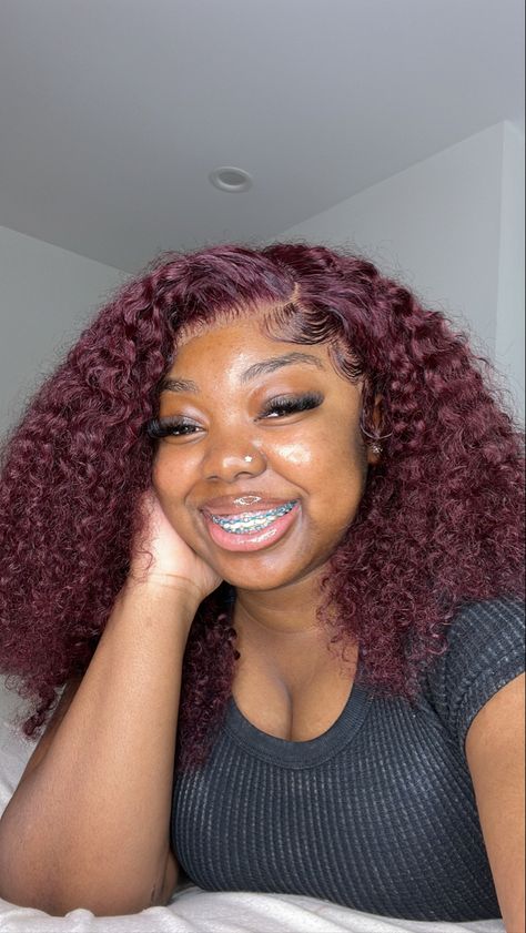 Power Chain Braces Black Women, Powerchain Braces Colors Ideas, Braces On Brown Skin, Braces Colours For Brown Skin, Brown Braces, Pink Power Chain Braces, Burgundy Braces, Cute Braces Colors For Light Skin, Cute Braces Colors For Dark Skin