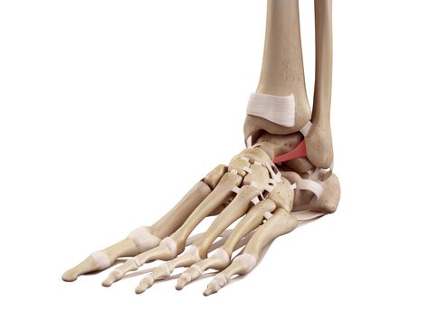 The anterior talofibular ligament High Ankle Sprain, Ankle Ligaments, Ankle Fracture, Ankle Sprain, Ankle Surgery, Ligament Tear, Ligaments And Tendons, Leg Bones, Knee Replacement Surgery