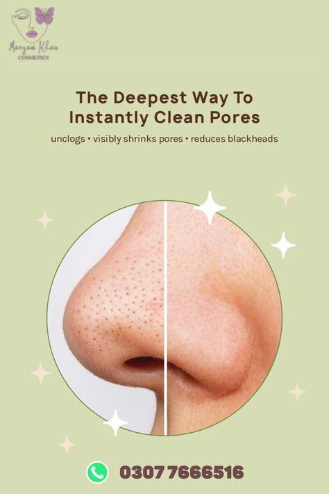 ORIGINAL APK NOSE STRIPS NOW AVAILABLE IN 599 PKR

SAY BYE TO DEAD PORES NOSE.

Nourish nose skinIt removes all dirt ,Pore ,Black heads from skin and makes nose skin shinier , clear .

#deal #sales #essence #makeup #cosmetics  #WhatsApp #XAUUSD #BackOurGirls #Iphone15 #PakvsSri Nose Peeling, Nose Pore Strips, Black Heads, Nose Pores, Blackheads On Nose, Blackhead Mask, Pimples On Face, Essence Makeup, Pore Strips