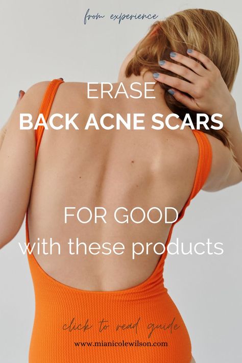 woman's back, guide showing how to get rid of back acne scars Get Rid Of Back Acne, Rid Of Back Acne, Best Acne Scar Removal, Acne Scar Remedies, Back Acne Remedies, Scar Remedies, Back Acne, Acne Skincare Routine, Home Remedies For Acne