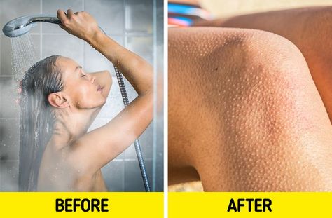 What Causes Chicken Skin, and 6 Ways to Get Rid of It Spots On Arms How To Get Rid, Acne On Arms How To Get Rid Of, How To Get Rid Of Chicken Skin On Arms, How To Get Rid Of Chicken Skin, How To Get Rid Of Razor Bumps On Armpits, How To Get Rid Of Red Bumps On Arms, Chicken Skin Remedy, Bumps On Arms, Skin Rash Remedies