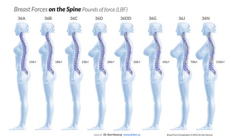 Spine Pain, Human Spine, Spine Surgery, Breast Reduction, Body Hacks, Strong Core, Poor Posture, Medical Knowledge, Brand Guide