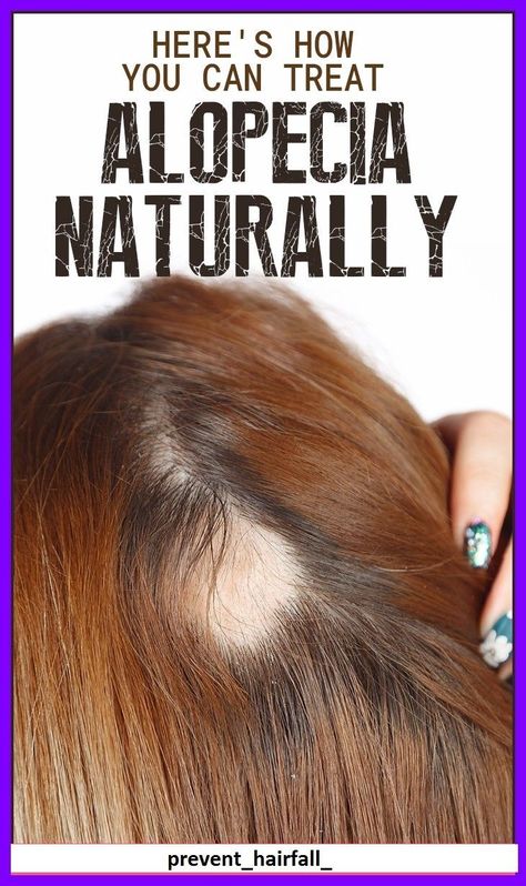 Hair fall might be a serious problem. But like most serious problems out there, it can be prevented and treated with simple home remedies. #hair #haircare #hairfall #remedies #homeremedies #HairLossNaturalRemedy #Hair #HairCare #HairFall #Remedies #hairloss #hormones #hormonalhairloss #haircare #haircaretips regrowth #hairstrong #longhair #stronghair Desserts Potluck, Hair Fall Remedy Home, Hair Fall Remedy, Girly Tips, Handmade Socks, Home Remedies For Hair, Healthy Advice, Regrow Hair, Birthday Blessings