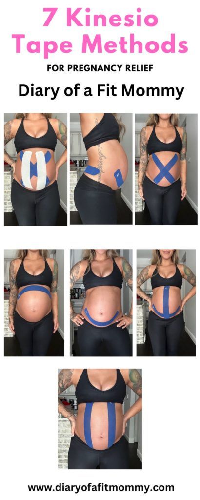 Kinesio Taping For Pregnancy Pain & Aches + 7 Taping Techniques That WORK! - Diary of a Fit Mommy Kenisiology Taping, Kinesiology Taping Pregnancy, Kt Tape Pregnancy, Stomach Muscle Separation, Work Diary, Sia Cooper, Muscle Separation, Round Ligament Pain, Traveling Pregnant