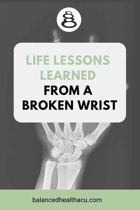 Life Lessons Learned from a Broken Wrist Wrist Fracture Exercises, Fractured Ankle Recovery, Broken Ankle Recovery Tips, Patella Fracture, Wrist Fracture, Fracture Healing, Wrist Exercises, Lessons Learned In Life, Live In The Present