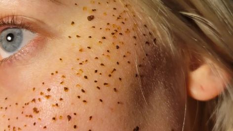 Henna tattoo freckles have been all the rage in recent years, but there are a few reasons why we're excited to see them decline in popularity. Tattoo Freckles, Henna Freckles, Freckled Skin, Tattooed Freckles, Gem Makeup, Black Henna, Face Gems, Natural Henna, Face Jewels