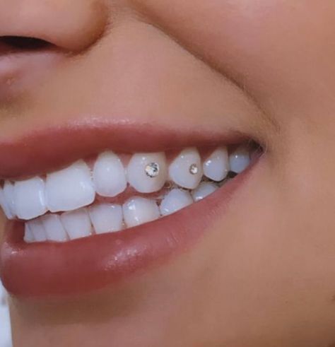 Rhinestone Tooth Gem, Aesthetic Teeth Gems, Rhinestone Teeth Gems, Gem On Tooth, Diamond On Tooth, Silver Tooth Gem, Teeth Jems Ideas, Diamond Tooth Gem Aesthetic, Tooth Jems Simple