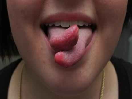 Tongue splitting. Ssssssssssss. Medical Diseases, Split Tongue, Plastic Surgery Procedures, Tongue Health, Nail Care Tips, Body Modification, Beauty Parlor, Body Piercings, Body Modifications