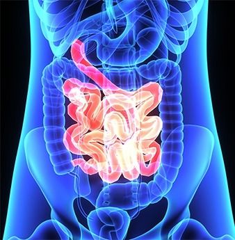 3 Reasons Why People Over 60 Need Probiotics - Organixx Gut Problems, Gastrointestinal Disease, Small Intestine Bacterial Overgrowth, Irritable Bowel, Gut Healing, Gut Microbiome, Types Of Cancers, How To, Probiotics