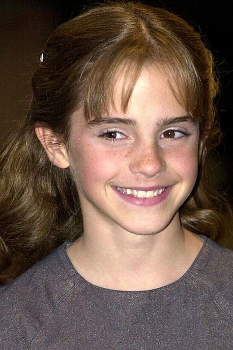 Emma Watson, Before and After | The Skincare Edit Emma Watson 2001, Emma Watson Young, Emma Watson Hair, Emma Watson Harry Potter, Harry Potter Hermione, Harry Potter Cast, Hermione Granger, Emma Watson, Hermione