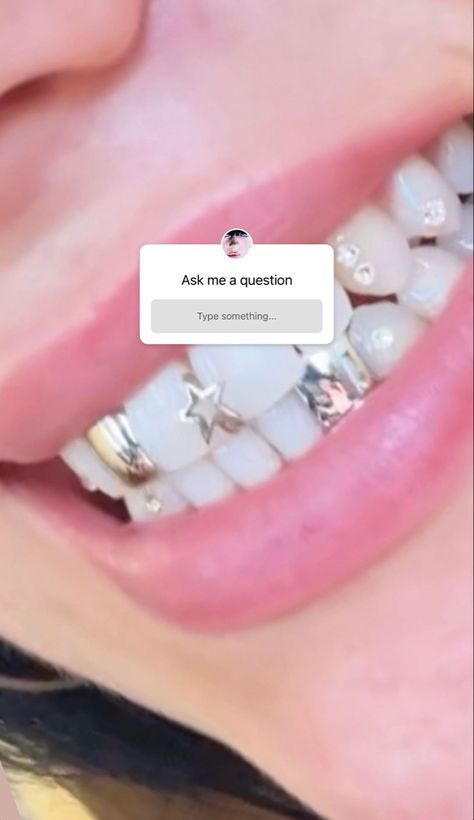 Teeth Piercing, Dental Jewelry, Diamond Teeth, Cute Tooth, Grills Teeth, Tooth Gem, Teeth Jewelry, I Am A Queen, Baby Art