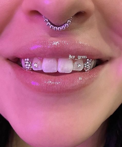 Women’s Teeth Grills, Bottom Tooth Gem, Teeth Gems Aesthetic, Teeth Diamond Aesthetic, Tooth Gem Ideas, Disco Ball Tooth Gem, Rine Stone On Teeth, Tooth Gems Ideas, Disco Tooth Gem