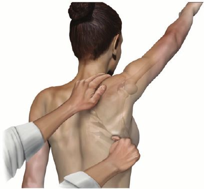 How to properly & permanently resolve scapular dyskinesis - MSK Neurology Winged Scapula Exercises, Scapula Exercises, Body Stretches Flexibility, Shoulder Rehab Exercises, Forward Head Posture Exercises, Neck And Shoulder Exercises, Shoulder Rehab, Shoulder Impingement, Neck And Shoulder Muscles