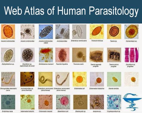 Web Atlas of Human Parasitology Microbiology Study, Medical Lab Technician, Parasitic Worms, Medical Laboratory Technician, Microbiology Lab, Clinical Chemistry, Medical Laboratory Scientist, Laboratory Technician, Medical Laboratory Science