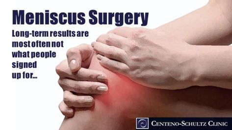 There’s a big chance you won’t be happy with your meniscus surgery. While surgeons often claim that at least three in five patients who undergo meniscus surgery are highly satisfied with their outcomes, the published literature actually supports the opposite. Read more. Meniscus Surgery Recovery, Shoulder Pain Remedies, Meniscus Surgery, Acl Surgery, Causes Of Back Pain, Cardiovascular Disorders, Ligament Tear, Stomach Muscles, Knee Surgery