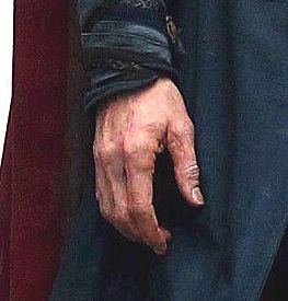 Hand With Scar, Arm Scar Reference, Doctor Strange Hands, Scars Over Hands, Scar Aethstetic, Scar Aethstetic Arm, Face Burn Scar Reference, Character With Scar On Face Male, Rough Hands