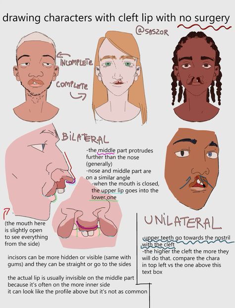 Man Lips Drawing Reference, Chewing Drawing Reference, How I Draw People In My Style, Cleft Lip Reference, Puckered Lips Drawing Reference, How To Draw Age, Cleft Lip Drawing, Lip Scars Reference, Body Types Names