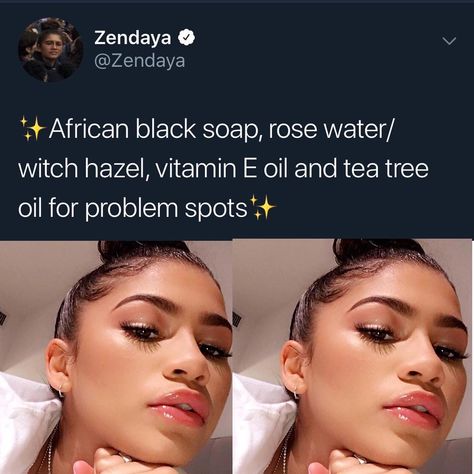 works well Face Care Routine, Black Skin Care, African Black Soap, Clear Skin Tips, Oily Skin Care, Black Soap, Instagram Link, Body Care Routine, Skin Care Remedies